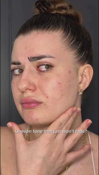 Anua Niacinamide 10 TXA 4 Serum 30ml