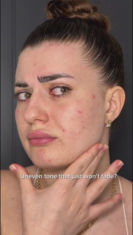 Anua Niacinamide 10 TXA 4 Serum 30ml